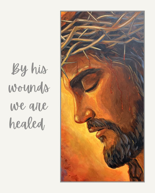 By His Wounds - Acrylic Print